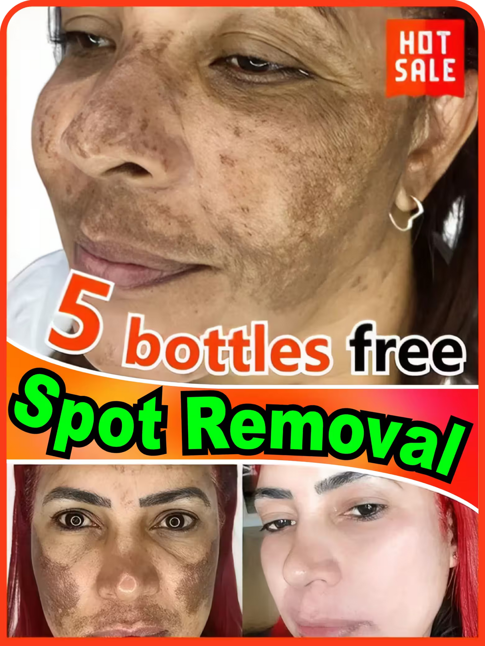 Advertisement for spot removal product showing a woman's face with dark spots and promotional text.