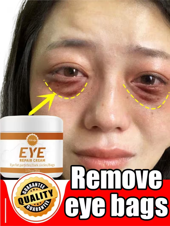Eye cream advertisement with a close-up of a person's eye and text 'Remove eye bags'.