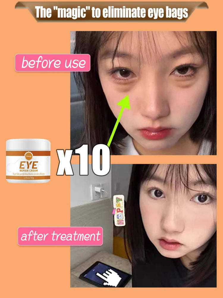 Before and after comparison of eye bag treatment with a product container labeled 'EYE'.