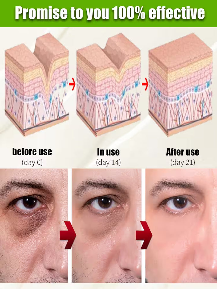 Before and after effects of a skincare product on skin layers and a person's eye area.